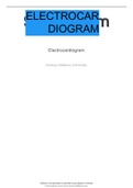 Electrocardiogram (ECG)  Diagnostic Procedure 