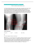 &lpar;answered&rpar; Assessing Musculoskeletal Pain Week 8 &vert; Assessment&semi; A 15-year-old male reports dull pain in both knees&period; 