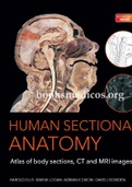 Human Sectional Anatomy 
