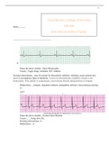 EKG Interpretation packet, NR 340 Critical Care Nursing