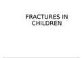 Fractures in Children