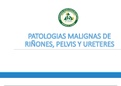 PATOLOGIAS MALIGNAS DE RIÑONES, PELVIS Y URETERES