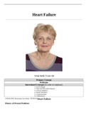 CS Heart Failure-JoAnn Smith, 72 years old , COMPLETE DOCUMENT FOR EXAM