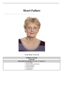 Case Study Heart Failure, JoAnn Smith, 72 Years Old (Updated FEB 2021), COMPLETE DOCUMENT FOR EXAM