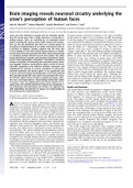 Samenvatting Biomedische Beeldvorming: Microscopie en Macroscopie (Behaald Resultaat 16/20): Macroscopie informatieve paper