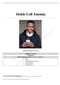 Sickle Cell Anemia case study&period;Anthony Perkins&comma; 15 years old