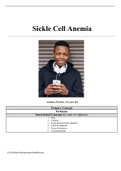 Sickle Cell Anemia (SCA) - KeithRN