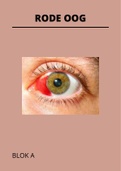 Alles wat je moet weten voor het theorietentamen van het Rode oog
