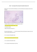 N675L Week 7 Quiz &ndash; Gynecology &lpar;GYN&rpar; and Sexually Transmitted Infections &lpar;STI&rpar;&lpar;Real quiz graded A&rpar;