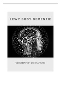 Lewy body dementie