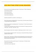 ECG RHYTHM STRIP EXAM 2024&sol;2025      