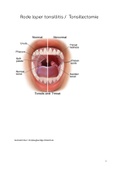     Rode loper tonsillitis /  Tonsillectomie