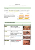 Samenvatting Optometrie KLOPTO  Jaar 2 Blok C - HC2 Netvlies van jong naar oud&comma; van voor naar achtersegment
