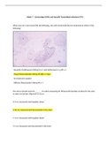 N675L Week 7 Quiz – Gynecology (GYN) and Sexually Transmitted Infections (STI)(Real quiz graded A)