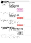 Foundations of EKG Interpretation - Prophecy Health Complete&sol; Prophecy EKG Terms And Explanations Altogether