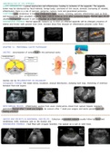 GASTROINTESTINAL, PERITONEAL, RETROPEROTONEUM PATHOLOGY - Ultrasound 