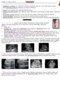 Pathology or urinary system Kidneys - Ultrasound