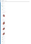 Module 4 Exam- Requires Respondus LockDown Browser&colon; Essential Human Anatomy and Physiology II with L