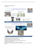 Samenvatting  Mondzorgkunde Parodontologie (MZK-PAROD) HAN Bachelor 1/ Propedeuse Collegejaar 2021-2022: Thema 7: Introductie orale implantaten