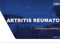 Fisiopatologia de la artritis reumatoide