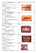 Samenvatting pathologie - lippen en mondholte