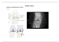 Basic interpretation of knee x ray