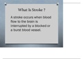 What-Is-Stroke-Presentation&period;pdf