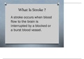 What-Is-Stroke-Presentation (1).pdf