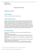 Red Eye SOAP Note Subjective History Chief Complaint &OpenCurlyDoubleQuote;My eye is red and irritated and is constantly tearing&period;&rdquo;