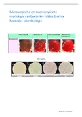 Microscopische en macroscopische morfologie van bacteriën in blok 1 minor Medische Microbiologie