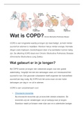 alles over copd
