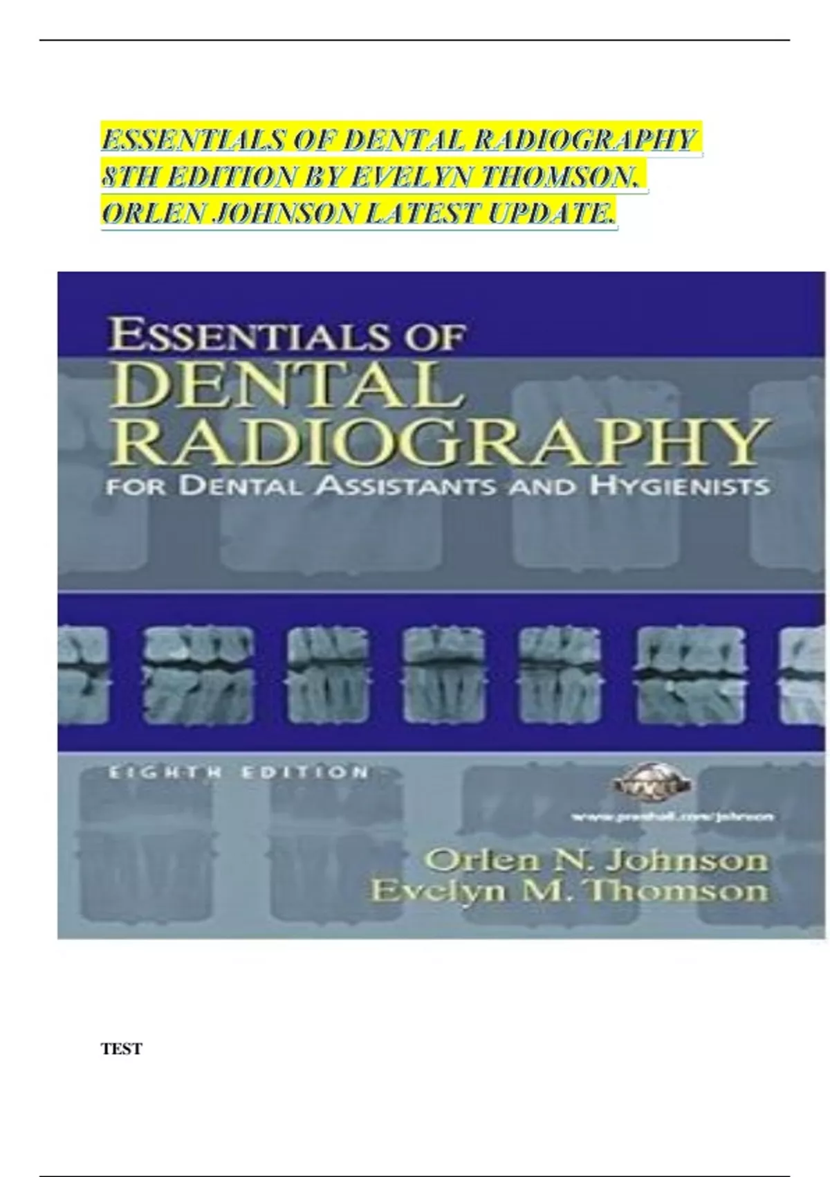 ESSENTIALS OF DENTAL RADIOGRAPHY 8TH EDITION BY EVELYN THOMSON, ORLEN ...