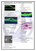 Ophthalmology Quiz - CSR, CME, ARMD and Macular Dystrophies