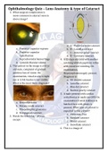 Ophtha Quiz_Lens Anatomy & Type of Cataract.