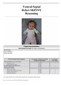 Ventral Septal Defect SKINNY Reasoning Mandy Gray, 2 months old
