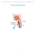 Verzorging tracheacanule
