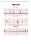 EKG strips document
