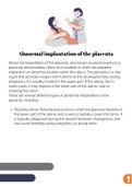 NCLEX notes Abnormal implantation of the placenta nclex rn exam 2023