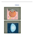 Summary  Optometry (B510)