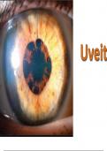 Uveitis and Systemic Diseases of the Eye&colon; A Comprehensive Overview