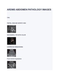 ARDMS ABDOMEN PATHOLOGY IMAGES 2023 &lpar; A&plus; GRADED 100&percnt; VERIFIED&rpar;