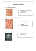 Dermatosis Eritematoescamosas