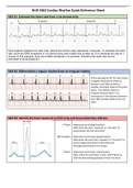 Cardiac Rhythms Quick Reference With Answers