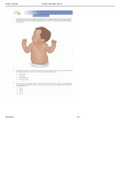 ATI RN Child Health Form B