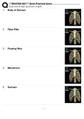 ***MASTER SET*** Bone Practical Exam(MPORTANT! USE FULL SCREEN MODE ON TOP LEFT OF FLASH CARDS! ** Description: These are all the terms from all the bone flashcards combined!! You will not be able to test with them as there will be multiple answers that a