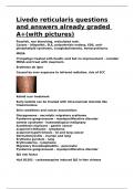Livedo reticularis questions and answers already graded A&plus;&lpar;with pictures&rpar;&period;