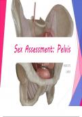 Assessing Sex Pelvis - &lbrack;LAB 6&rsqb;