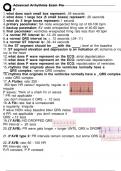 ADVANCED ARRHYTHMIA EXAM PREP WITH A GRADED ANSWERS