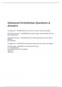 Advanced Arrhythmias Questions & Answers