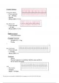 Dysrhythmias study guide questions with verified answers latest update 2025